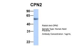 CPN2 Rabbit anti-Human, Polyclonal, Novus Biologicals 0.1 mL | Buy Online | Novus Biologicals | Fisher Scientific
